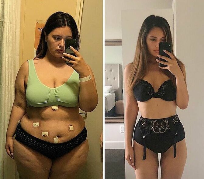Meitene pirms un pēc svara zaudēšanas ar kapsulām KETO Complete